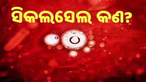 ମାରାତ୍ମକ ରୋଗ ସିକଲସେଲ ଲକ୍ଷଣ ପ୍ରତି ଧ୍ୟାନ ଦେଲେ ବଞ୍ଚିବ ଜୀବନ