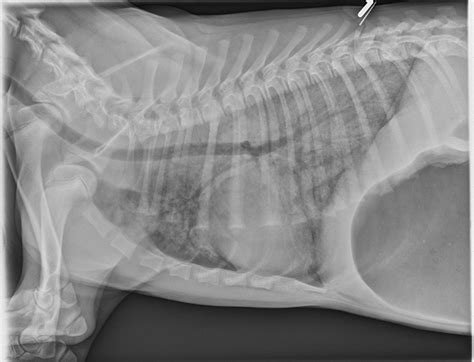 Smoke Inhalation | Clinician's Brief