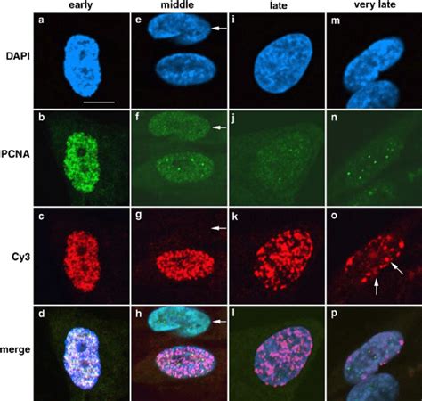 Localization Of DNA Replication Foci And PCNA In Interphase Nuclei Of