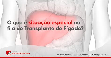 O Que Situa O Especial Na Fila Do Transplante De F Gado Cl Nica