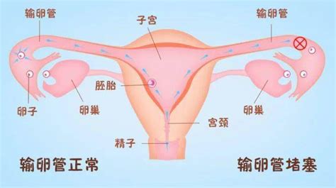 久备不孕，这5类人群一定要检查输卵管！女性情况原因