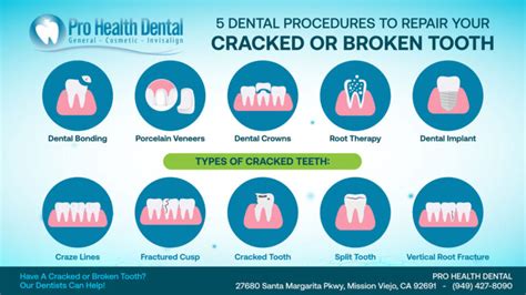 Types Of Cracked Teeth And Procedures To Treat Them Pro Health Dental