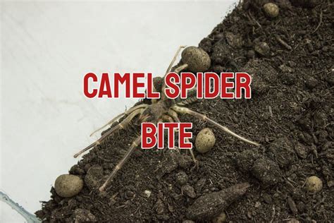 Camel Spider Bite Symptoms And Treatment With Pictures