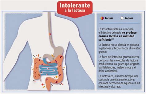 Alimentación saludable Tengo Intolerancia a la lactosa