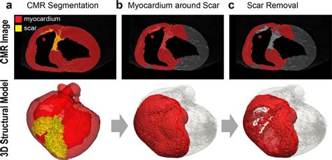 The Proposed Pipeline For Building The 3d Structural Viable Myocardium