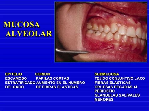 Epitelio Mucosa Oral