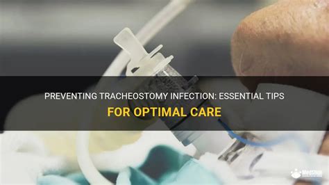 Preventing Tracheostomy Infection Essential Tips For Optimal Care