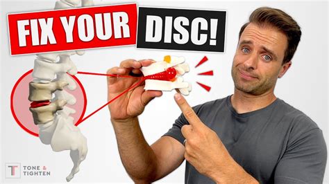 FIX YOUR DISC! Bulging Disc Lower Back Exercises For Pain Relief