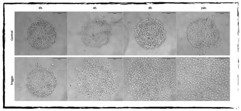 Cell migration on micropattern - 4Dcell