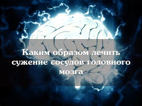 Каким образом лечить сужение сосудов головного мозга - YouTube