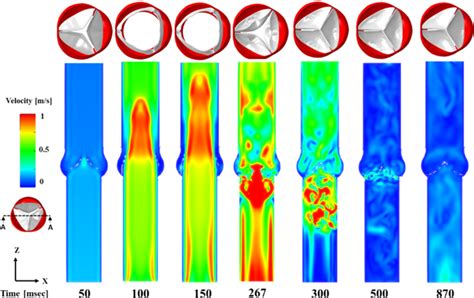 Fluidstructure Interaction Modeling Of Compliant Aortic Valves Using