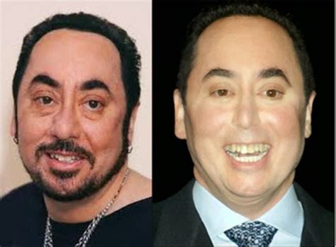 David Gest Plastic Surgery Facelift Before and After Images