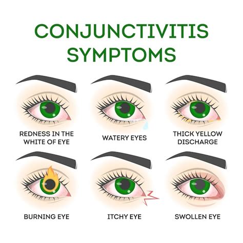 Conjunctivitis Red Eye Disease Hot Sex Picture