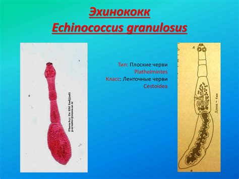 Эхинококк - презентация онлайн