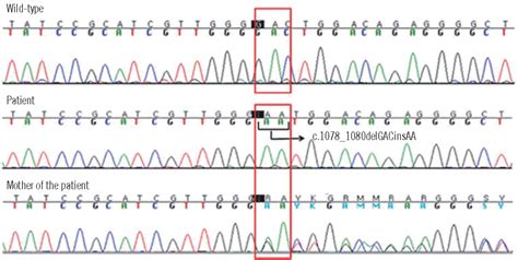 Figure 2 From Rapid Determination Of Chimerism Status Using