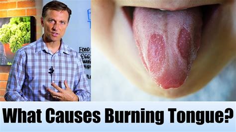 What Causes Burning Tongue with Healthy Keto™ Dr. Berg