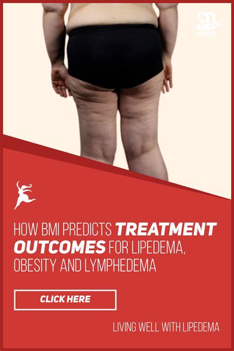 Pin By Lipedema Simplified On Treatment For Lipedema And Lymphedema In 2021 Lymphedema