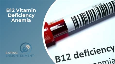 All About B12 Vitamin Deficiency Anemia — Eating Enlightenment