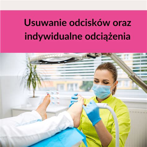 Usuwanie odcisków oraz indywidualne odciążenia część teoretyczna