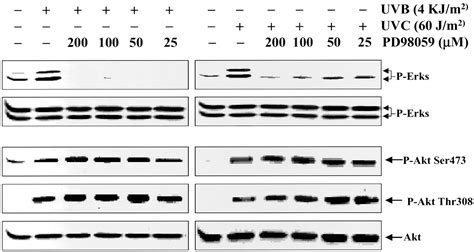 Uv Induces Phosphorylation Of Protein Kinase B Akt At Ser And Thr