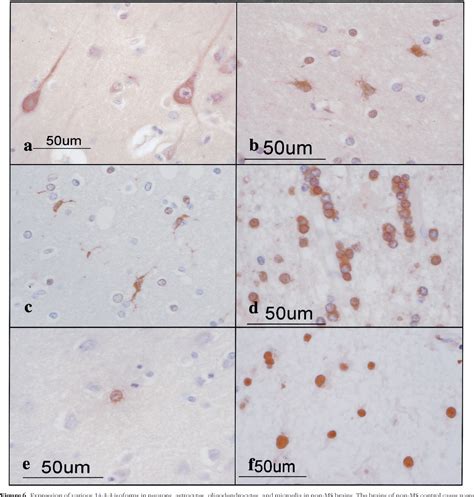 Figure From The Protein Cid Isoform Expressed In Reactive