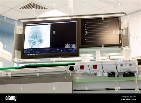 Human Head X Ray Image On A Computer Monitor In A New Neurosurgery Room