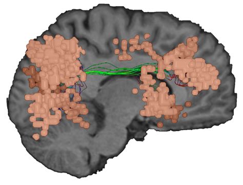 The Ventral Attention Network