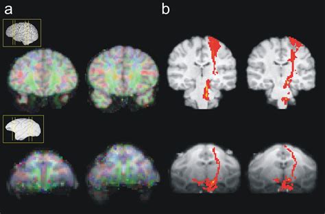 Quantitative Investigation Of Connections Of The Prefrontal Cortex In