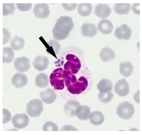 Pathogens Free Full Text Anaplasma Phagocytophilum And Anaplasma