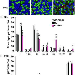 Muscle Fiber Typing Of Wild Type And PTN Overexpressing Mice After 14