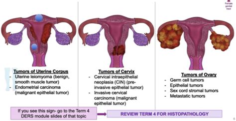 25 Tumors Of Female Genital Tract Flashcards Quizlet