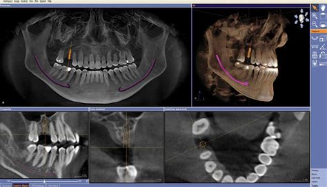 Three Dimensional Dental Imaging And Scans