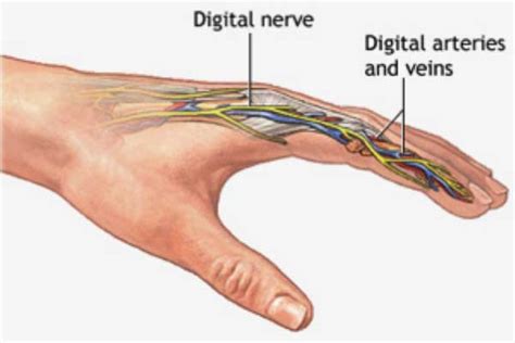 Digit Replantation Results In Better Outcomes Vs Revision Amputation