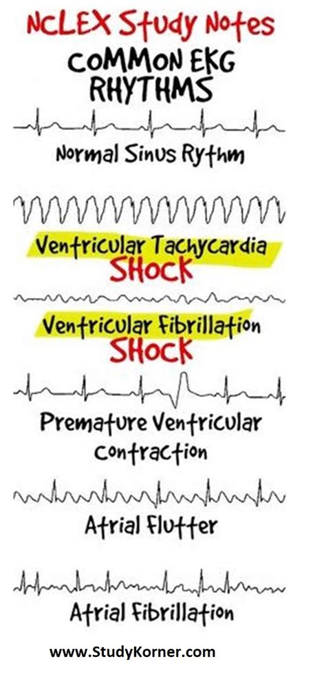 Ekgecg For Nursing Students How To Read An Electrocardiogram Nclex Quiz