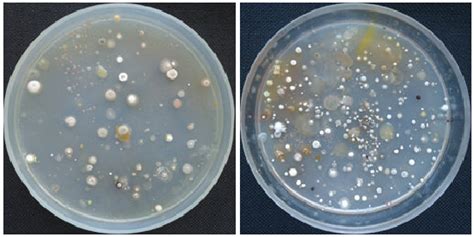 Actinomyces Colony Morphology