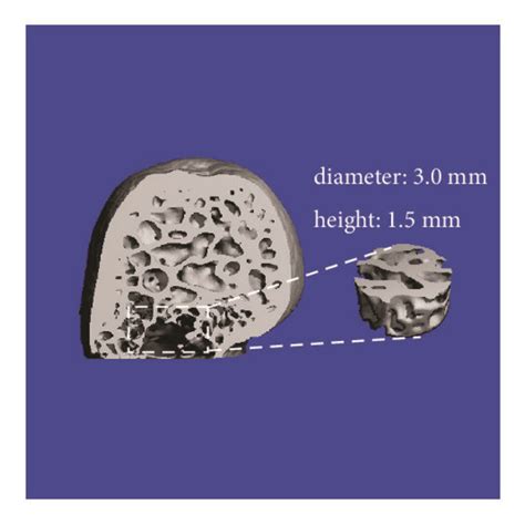 Representative Micro CT Images From Each Group The Trabecular Bone In