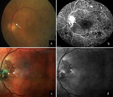 Clinical Applications Of Multicolor Imaging