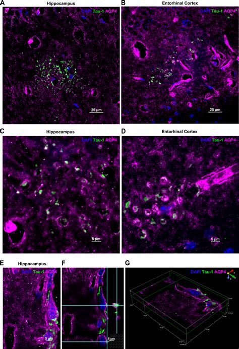 Aquaporin 4 And Tau Colocalization A Hippocampus And B Entorhinal