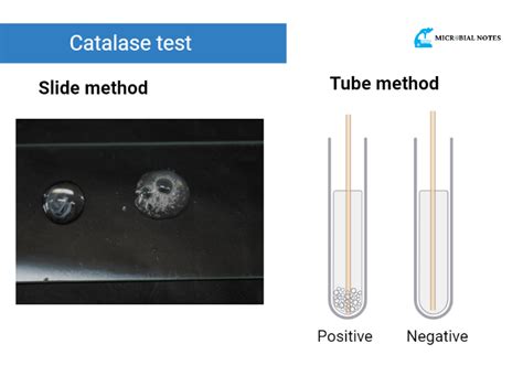 Catalase Test Procedure Principle And Uses Medical Test Technology Hot Sex Picture