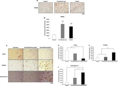 Knockdown Of Mortalin Decreased Pcna Expression And Induced Apoptosis Download Scientific