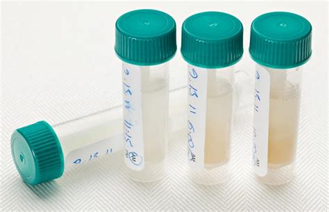 DNA And RNA From Saliva Revvity Chemagen Technologie GmbH