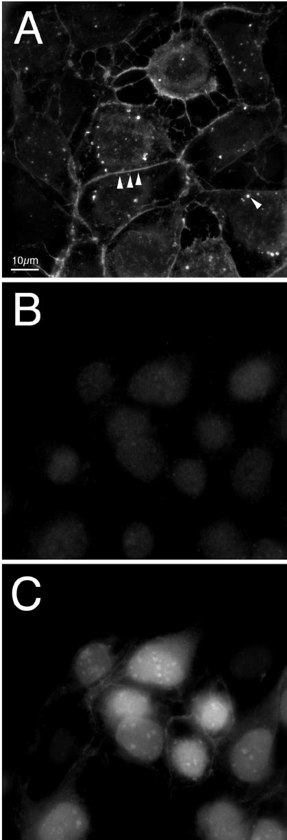 Prv Us Localization In Infected Cells Indirect Immuno Fl Uorescence