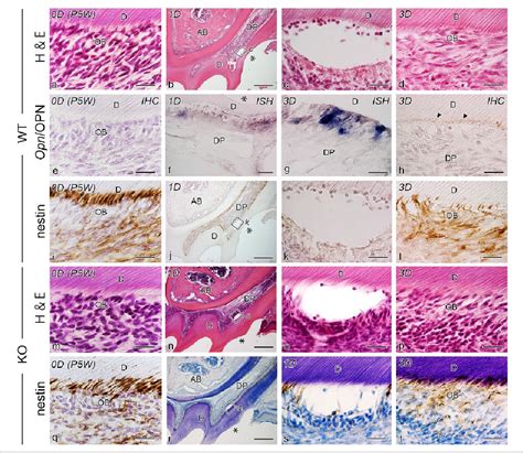 Figure From Osteopontin Is Essential For Type I Collagen Secretion In