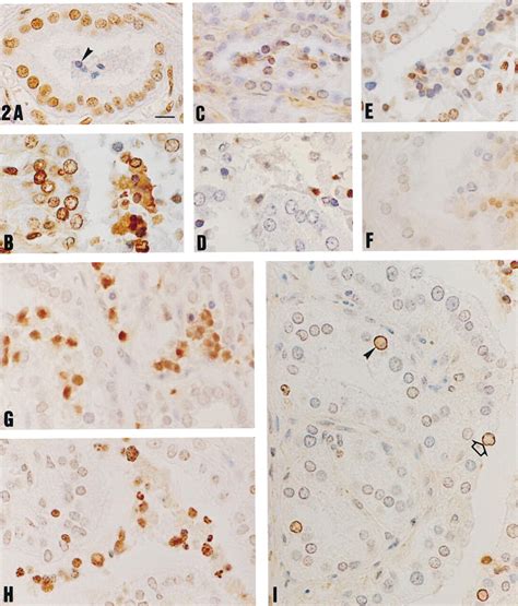 Tunel Apoptotic Cell Detection In Tissue Sections Critical Evaluation