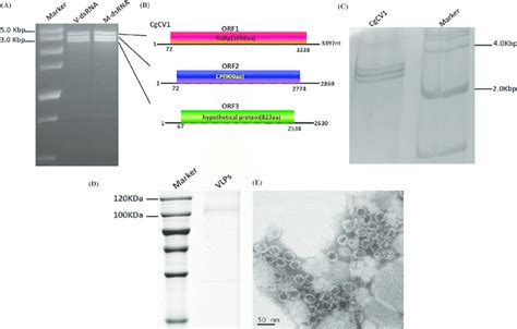 Agarose Gel Electrophoresis Of Double‐stranded Rna Dsrna Isolated Download Scientific Diagram