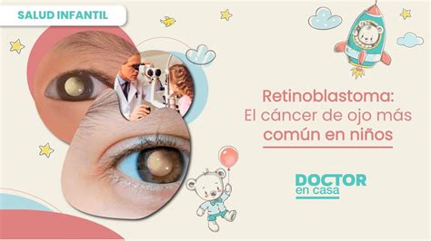 Retinoblastoma El cáncer de ojo más común en niños YouTube