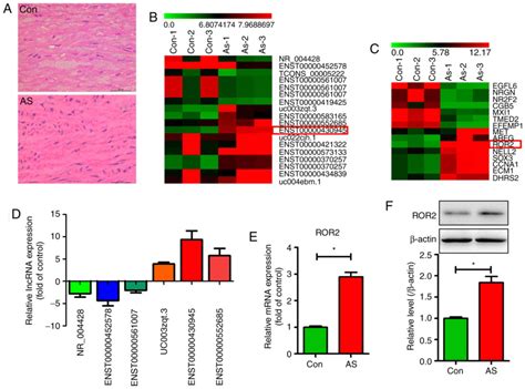 Lncrna Promotes The Proliferation And Migration Of Vascular