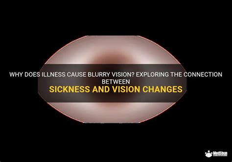 Why Does Illness Cause Blurry Vision Exploring The Connection Between