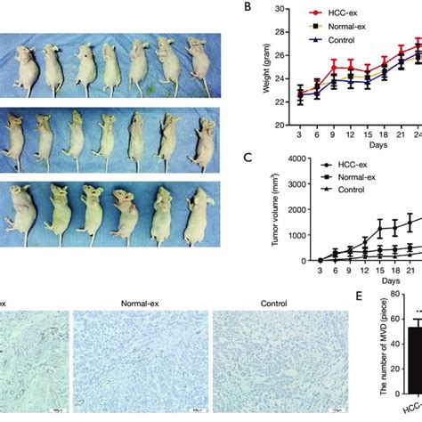 Hcc Exosomes Promote Xenograft Tumor Growth And Angiogenesis A