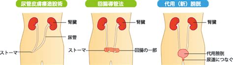 大阪公立大学医学部 泌尿器科学教室